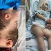 Сиамских близнецов в Бразилии разделили с помощью виртуальной реальности