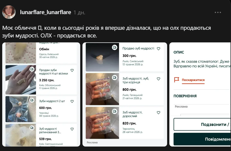 Зуби мудрості продають на OLX: скільки коштує один зуб і хто їх купує